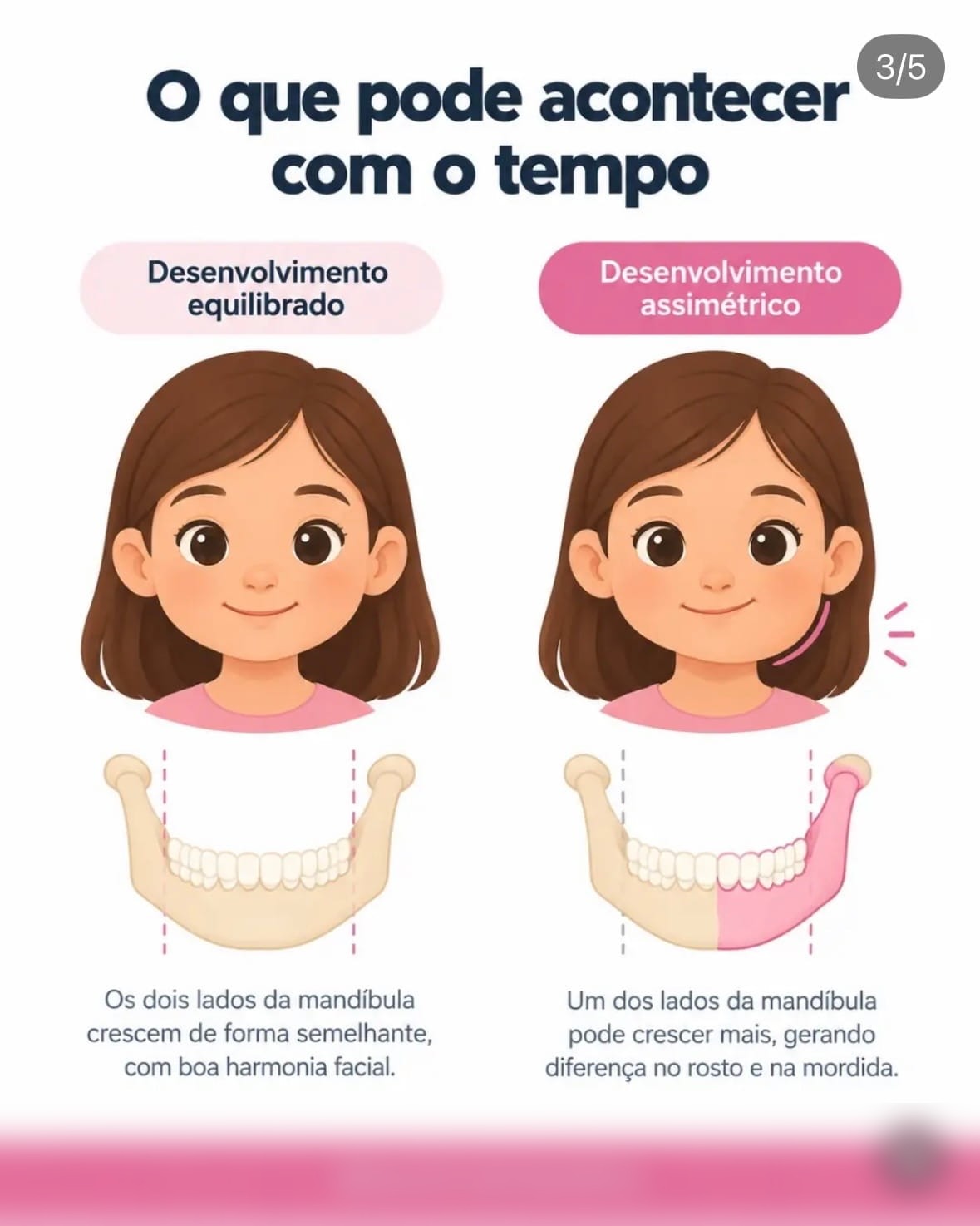 Slide 3 do carrossel de odontopediatria gerado pela DAI