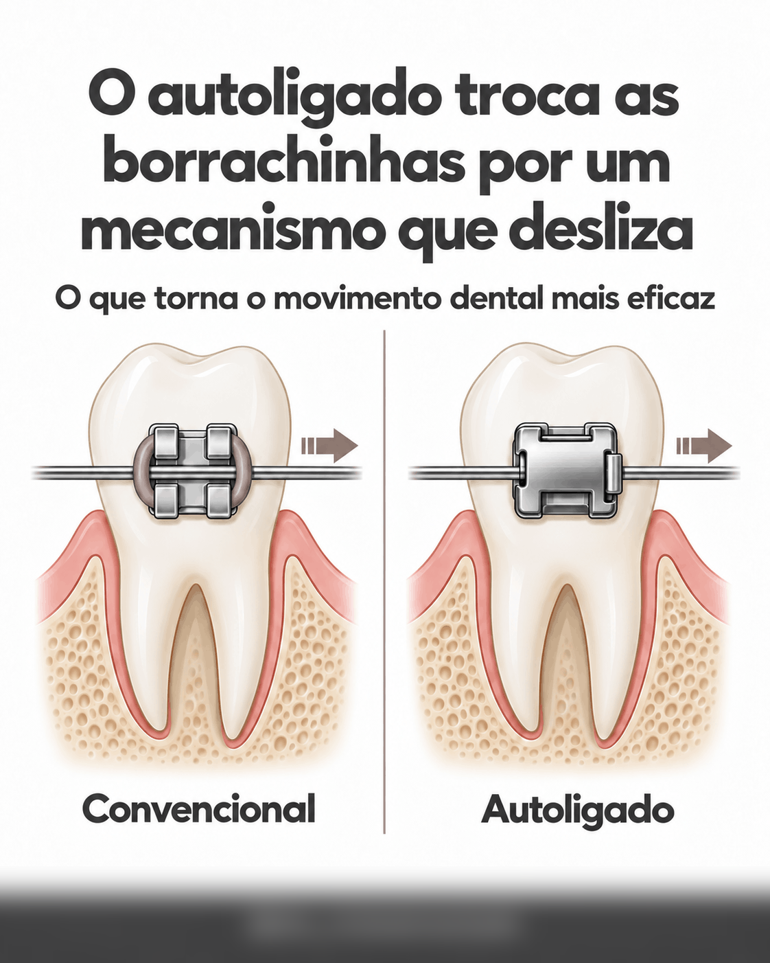 Slide 3 do carrossel de ortodontia gerado pela DAI